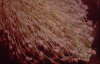 R�hrenpolyp